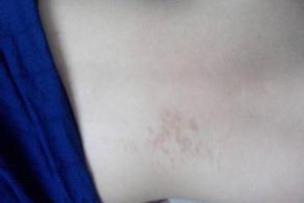 后背胎记算命