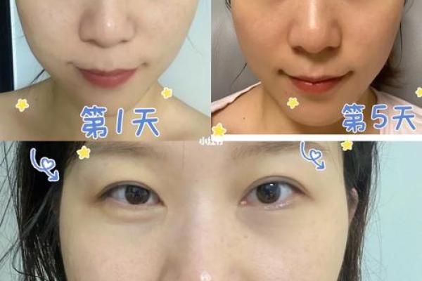 八字与皮肤 八字影响肤质