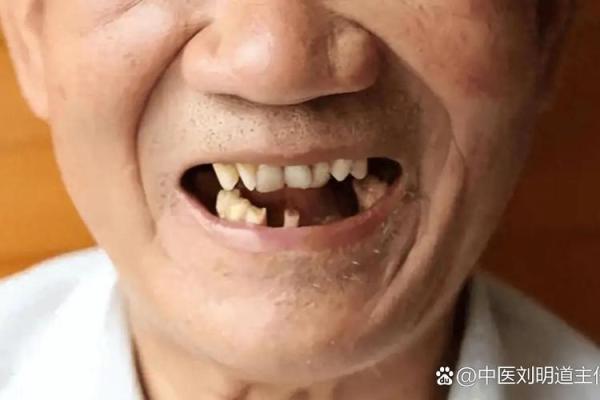 八字牙齿