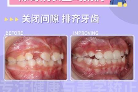 八字牙齿