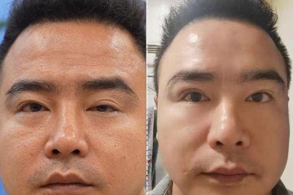 风水男人面相眼睛小预示有什么性格特征