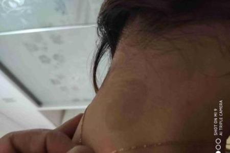 身上胎记算命图解