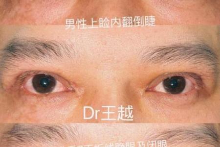倒八字眼睛