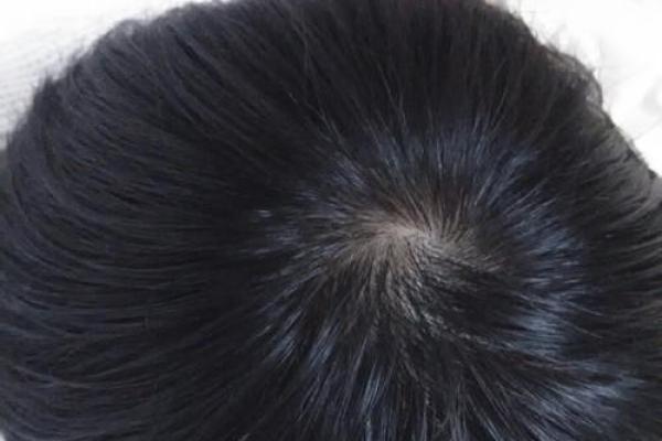 紫薇斗数发旋