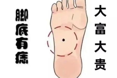 脚上胎记算命，脚底长胎记好不好