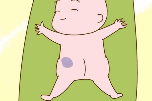 屁股上有胎记算命分析