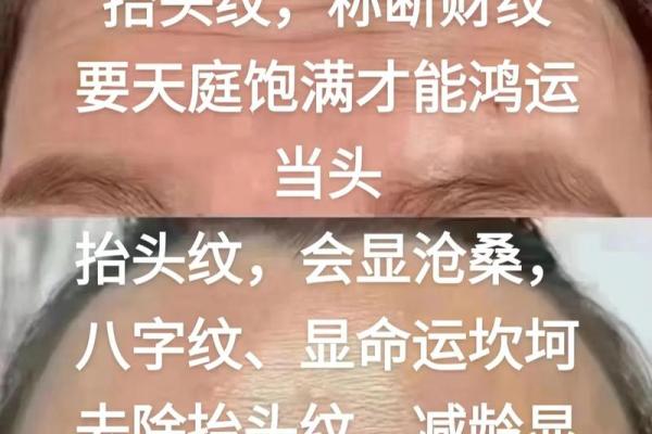 八字纹怎么去除