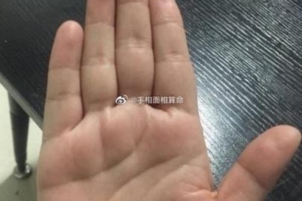 后脑勺有三条竖杠 后脑勺头皮三条竖纹算命