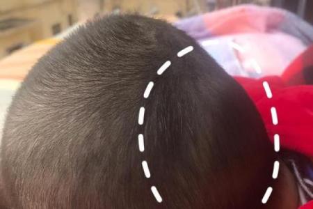 后脑勺有三条竖杠 后脑勺头皮三条竖纹算命