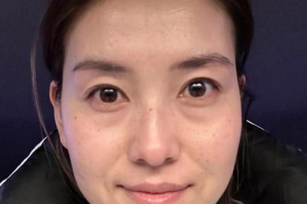 八字纹的女人是穷相吗？