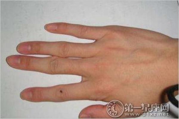 手指内侧长红胎记算命准吗