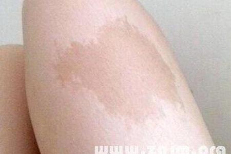 胎记算命图,后背胎记全面图解