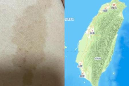 风水学上胎记中的有说明什么
