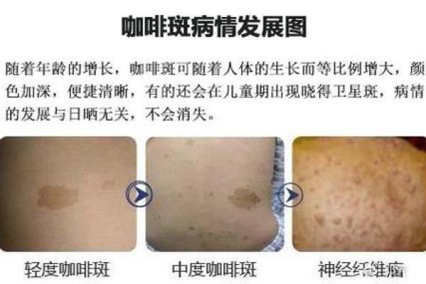 面部上的胎记算命分析