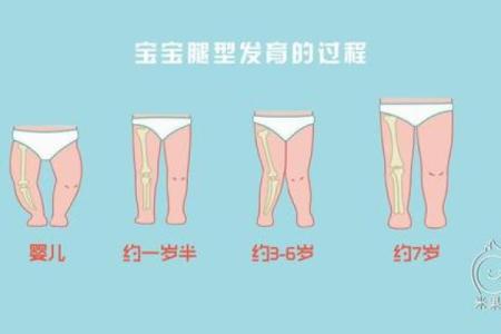 婴儿八字腿