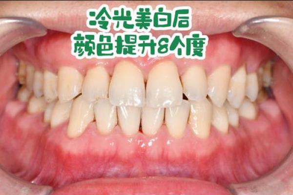 牙齿算命：牙齿的颜色看你的运势