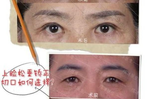八字眉眉尾下垂的男人适合结婚吗