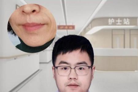 鼻子两侧八字纹图片