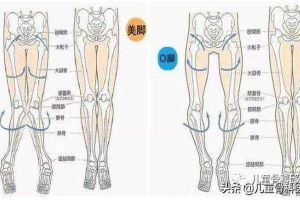 外八字危害
