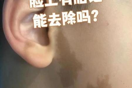脸上胎记算命图解