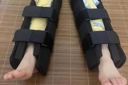 外八字绑腿