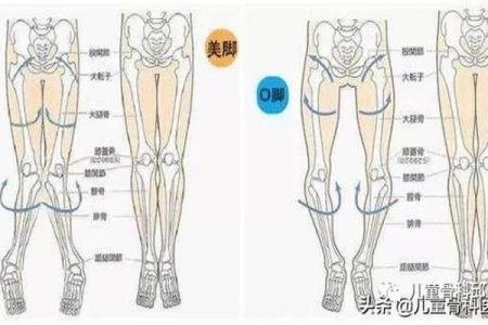 外八字危害