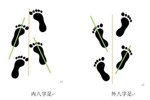 外八字性格