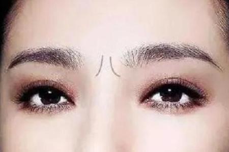 眉间八字纹消除