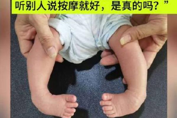 儿童内八字脚