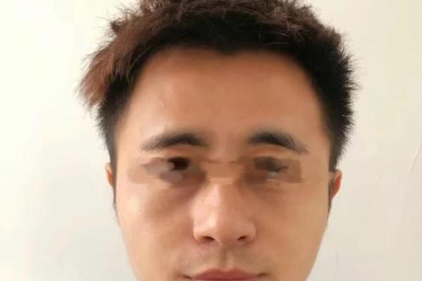 八字眉眉尾下垂的男人